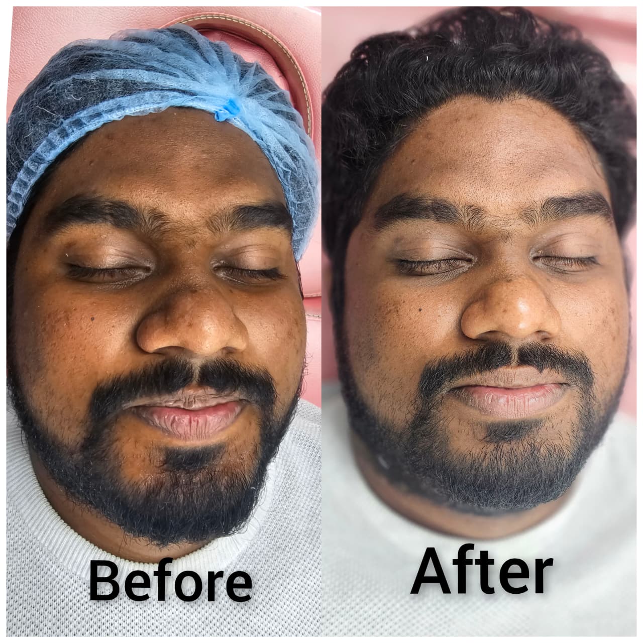 Insta Glow Solutions