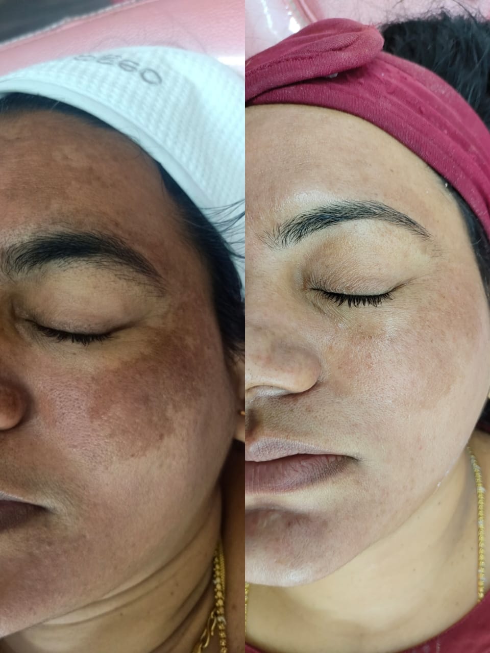 Insta Glow Solutions